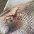 Injured dhu  